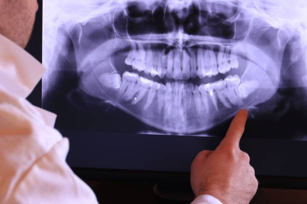 Best Emergency Dental Care for Broken or Chipped Teeth in Aust, IN