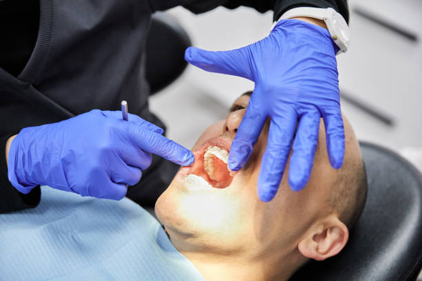 Best Emergency Treatment for Dental Infections or Abscesses in Aust, IN